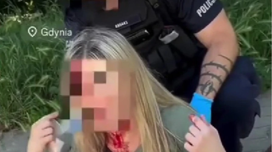 Напад на українку в Гдині: чому справа резонує за межами Польщі